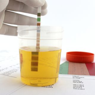 Barieră naturală împotriva infecțiilor